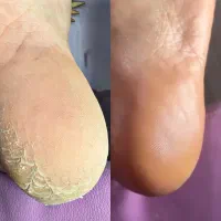 آموزش و‌خدمات پدیکور،اسپا و کفسابی درمانی و ریلکسی|خدمات آرایشگری و زیبایی|کرج, گلشهر|دیوار