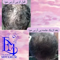 مطب پوست،مو،زیبایی دکتر الهام متمم|خدمات آرایشگری و زیبایی|رشت, گلسار|دیوار