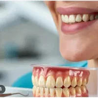 دندانسازی(دندان مصنوعی) طرح لمینت