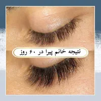 مژه ها و ابروهات رو تقویت کن
