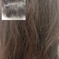 موخوره گیری روسی