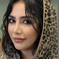 عمل جراحی بینی وترمیم بدون کبودی با پیزو/لیفت|خدمات زیبایی و سلامت|کرج, چهارصد دستگاه|دیوار