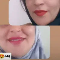 درمان تمامی مشکلات با محصولات ماسکانی|آرایشی، بهداشتی، درمانی|اصفهان, باغ فردوس|دیوار