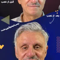کاشت مو‌بدون جراحی  (پروتز مو‌بدون‌چسب)|خدمات آرایشگری و زیبایی|درگهان, |دیوار
