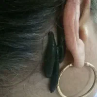 حجامت  زالو درمانی فصد بادکش گرم  حلزون تراپی