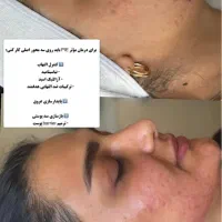 خدمات باورنکردنی|خدمات آرایشگری و زیبایی|مشهد, ابوذر|دیوار