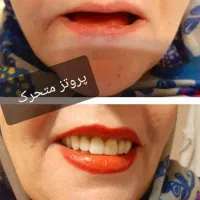 دندانسازی ناب نصف قیمت بازار|پزشکی|شیراز, حجت آباد|دیوار