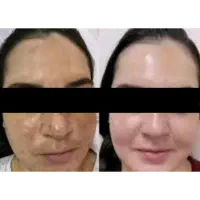 کرم گیاهی|آرایشی، بهداشتی، درمانی|آستارا, |دیوار