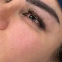 کاشت ابرو