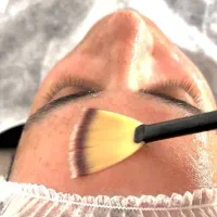 مدل برای اسیدتراپی|خدمات آرایشگری و زیبایی|رشت, پورسینا|دیوار