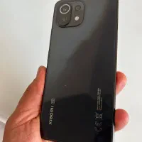 Mi11 lite 5G NE