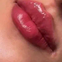 جشنواره لیزر مو تزریق ژل لب بوتاکس فیلر جوانساز|خدمات آرایشگری و زیبایی|تهران, صادقیه|دیوار