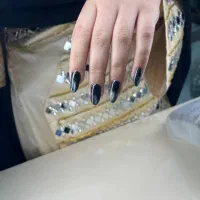 کاشت ناخن زابل