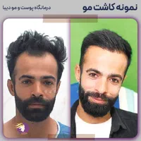(+فیلم) کلینیک کاشت مو، ابرو و ریش|خدمات آرایشگری و زیبایی|تهران, صادقیه|دیوار