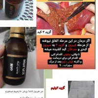 دمنوش و روغن مختص کبدچرب|خوردنی و آشامیدنی|امیرآباد, |دیوار