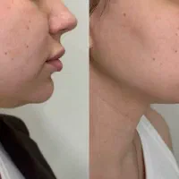 مطب فارابی افریلدا تاولنتاین صورت زیبا اندامی جذاب