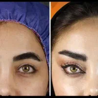 جشنواره تخفیف جراحی زیبایی شقیقه،بلفارو،دایرکت|خدمات آرایشگری و زیبایی|پرند, فاز ۲|دیوار