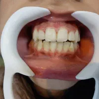 درمان دندانپزشکی اطفال و بزرگسال در مطب و اتاق عمل