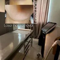 لیزر موهای زائد افرو بدون درد تضمینی