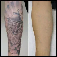 ریموتتو ابرو و بدن با پیشرفته ترین دستگاه تضمینی|خدمات آرایشگری و زیبایی|اهواز, کیانپارس |دیوار