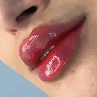 خدمات زیبایی و بوتاکس و فیلر|خدمات آرایشگری و زیبایی|شیراز, آزادگان|دیوار