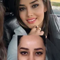 جراحی بینی با قیمت استثنایی|خدمات آرایشگری و زیبایی|بروجرد, |دیوار