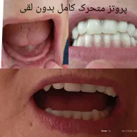 لابراتوار لبخند زیبا مبلغ ۱۵ میلیون و چک صیادی|خدمات آرایشگری و زیبایی|آباده, |دیوار