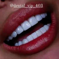 کامپوزیت دندان