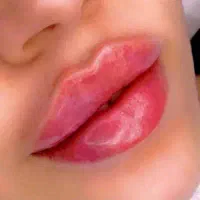 کلینیک زیبایی حرفه ای در سطح شهر (رایگان)