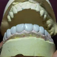 دندانپزشکی و دندان سازی خیریه چمران (جراحی. زیبایی|خدمات زیبایی و سلامت|تهران, امام حسین|دیوار