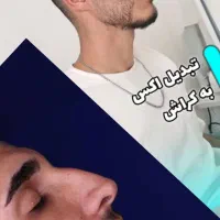 عمل بینی لیفت صورت اقساط تا۲۴ ماه|خدمات آرایشگری و زیبایی|تهران, تجریش|دیوار