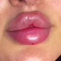 کلینیک زیبایی فیلرلب روسی و مدلینگ عربی
