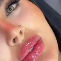 جشنواره عیدانه ژل ،فیلر ،غبغب،بلفا آنزیم،نقد اقساط