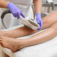 لیزر موهای زائد