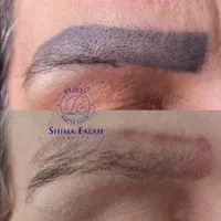 ریمو تتو،ریموو ابرو|خدمات آرایشگری و زیبایی|مشهد, صیاد شیرازی|دیوار