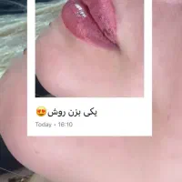 انجام تمامی خدمات فیلرو ساکشن و لابیا پلاستی