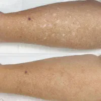 اولین مرکز تخصصی تاتوپزشکی بهشت|خدمات زیبایی و سلامت|تهران, عباسآباد|دیوار