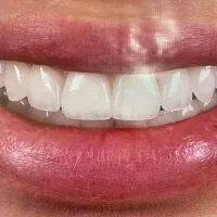 لابراتوار و دندانسازی