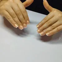 کاشت تخصصی خدمات ناخن و احیای مو