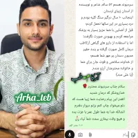 دفع سنگ کلیه بدون درد بدون بستری|خدمات آرایشگری و زیبایی|یاسوج, |دیوار