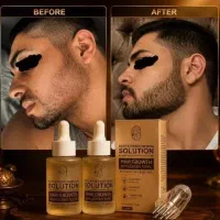 پشماتو درمیارم تضمینی