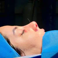 جراحی زیبایی بینی توسط جراح متخصص گوش وحلق و بینی