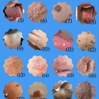 درمان رو شروع کن