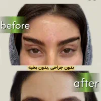 مرکز تخصصی تزریق فول فیس چربی و فیلر/لیفت با نخ|خدمات آرایشگری و زیبایی|مشهد, هنرستان|دیوار