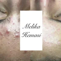 فیشیال و جوانسازی و پاکسازی صورت|خدمات آرایشگری و زیبایی|اصفهان, خلجا|دیوار