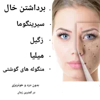 خالبرداری،زگیل، سیرنگوما در یک دقیقه