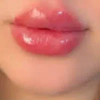 ژل وبوتاکس.برداشتن خال.فیلربینی انزیم پاککردن تاتو|خدمات آرایشگری و زیبایی|مشهد, طبرسی شمالی|دیوار