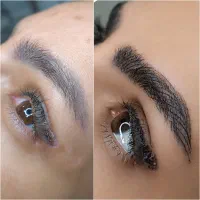 خدمات میکروی ابرو (فیبروز ) هزینه اقتصادی