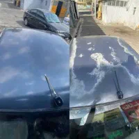 رفع آفتاب سوختگی کاملا تضمینی
