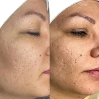 فیشال مدل|خدمات آرایشگری و زیبایی|اصفهان, سرچشمه|دیوار